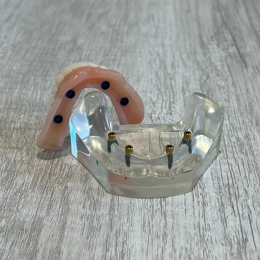 snap-in implant dentures Wiggins, MS